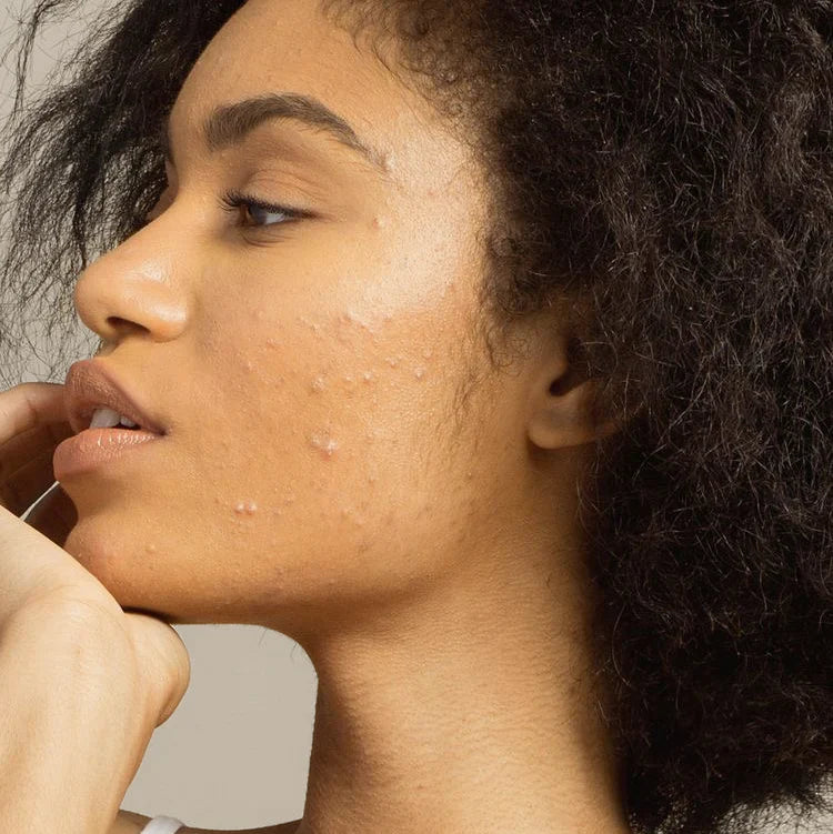 Imperfections : on s’en occupe !